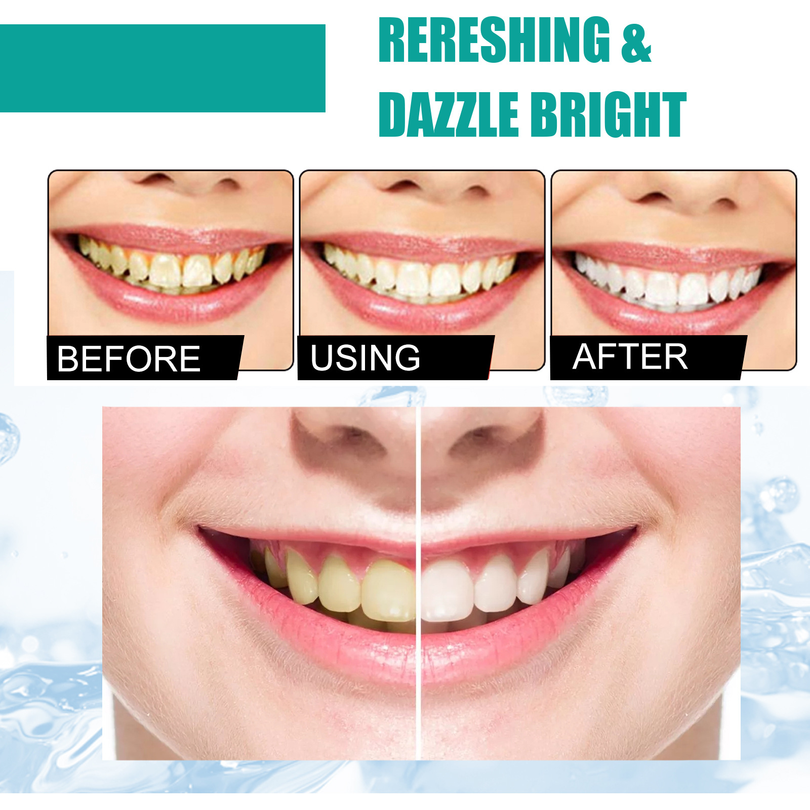 Bubuk Gigi Mint Nafas Segar 5  - Teeth Whitening Near Me ulasan dan harga